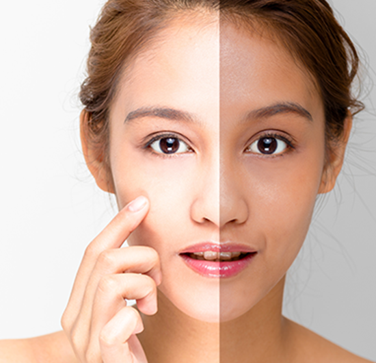 Skin Polishing Benefits